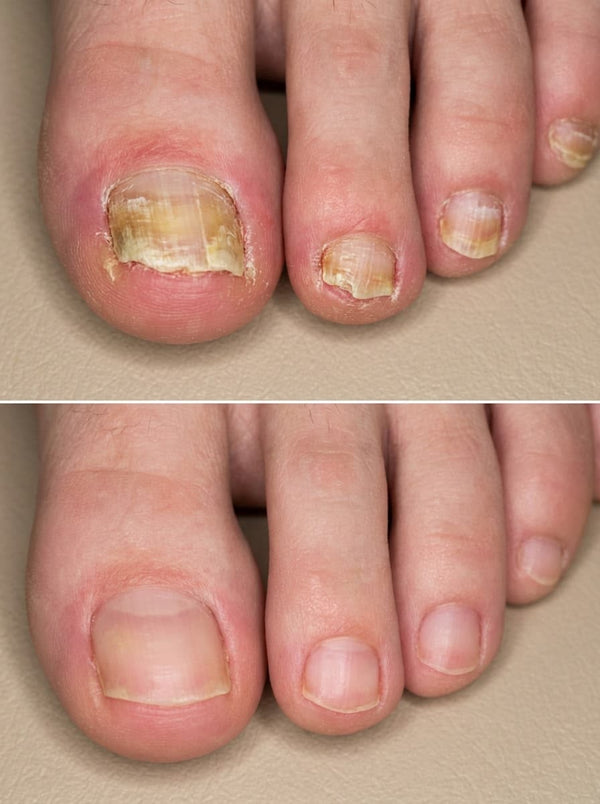 Lunavia Antifungal Relief Pen